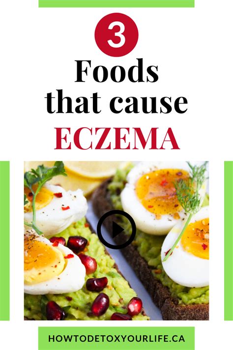 What Cause Eczema Food